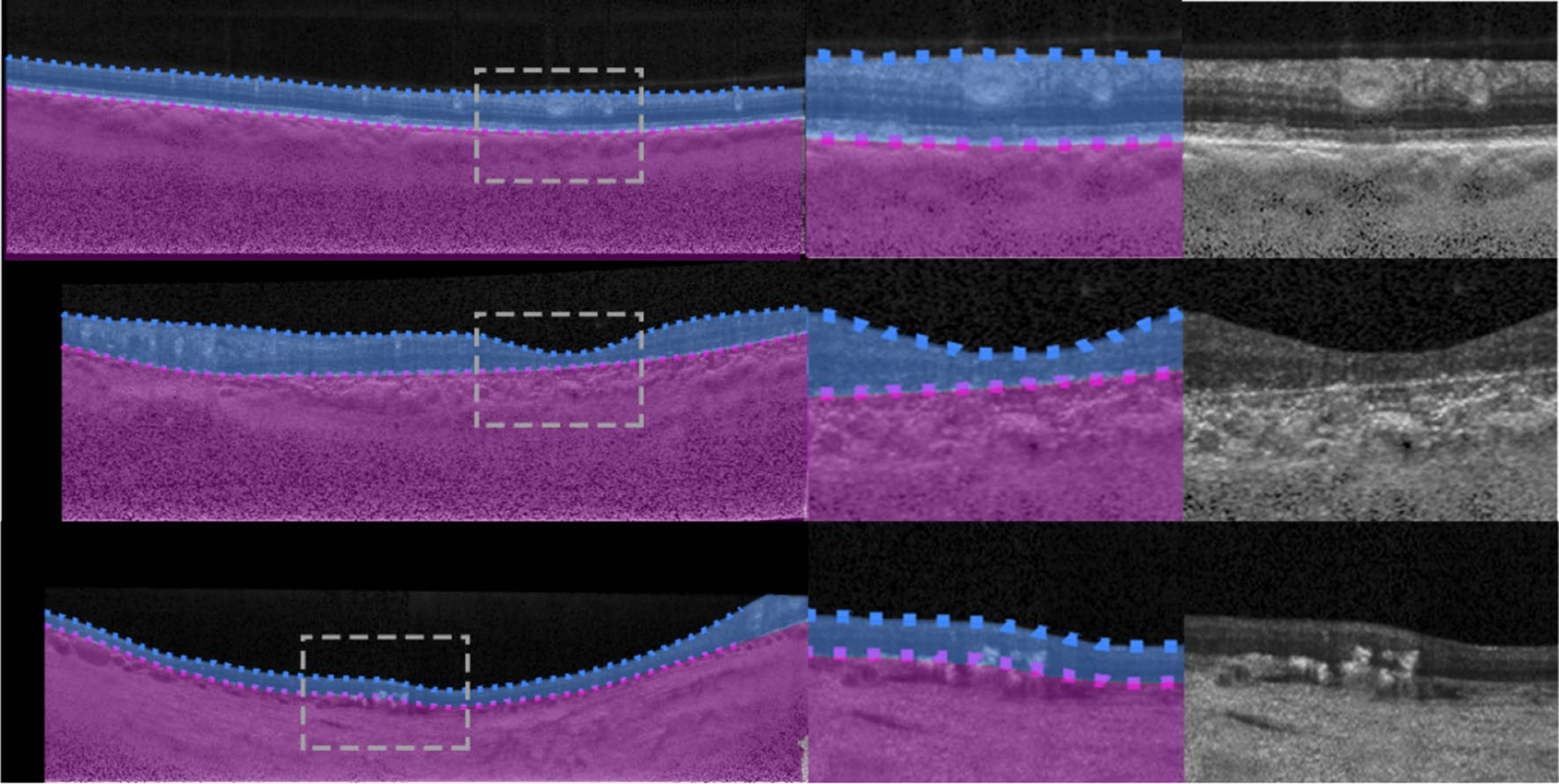 Single-line optical waveguides